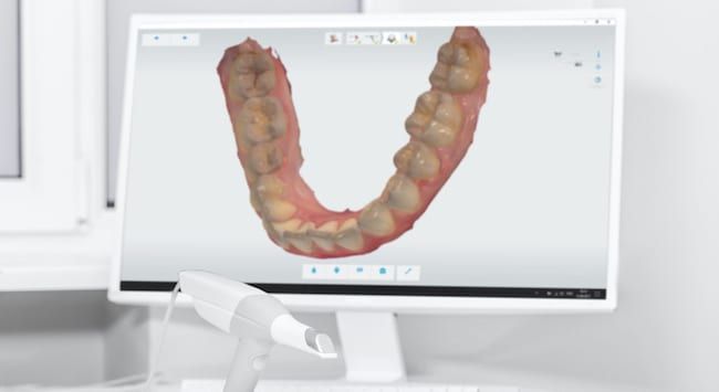 White picture of computer displaying dentures